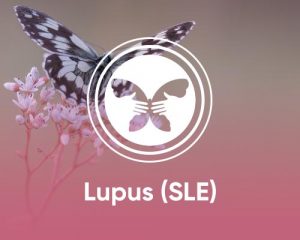lupus-drceyhunnuri-min Lupus SLE Tedavisi - Fitoterapi ve Osteopati Dr. Ceyhun Nuri